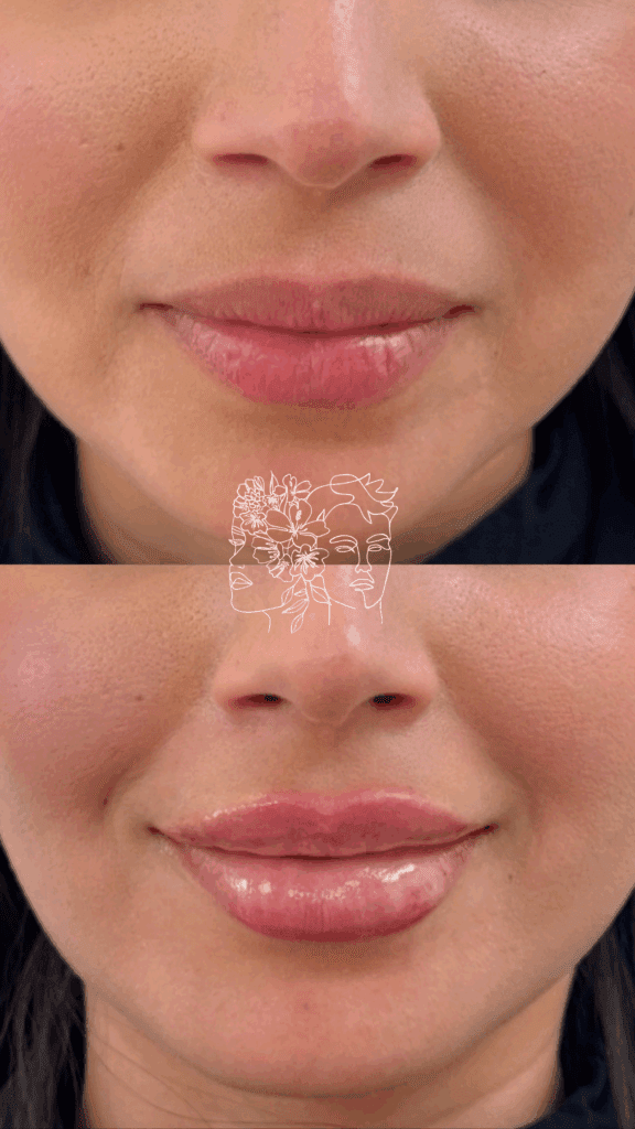 Gallery 15 a close up of a woman's lips