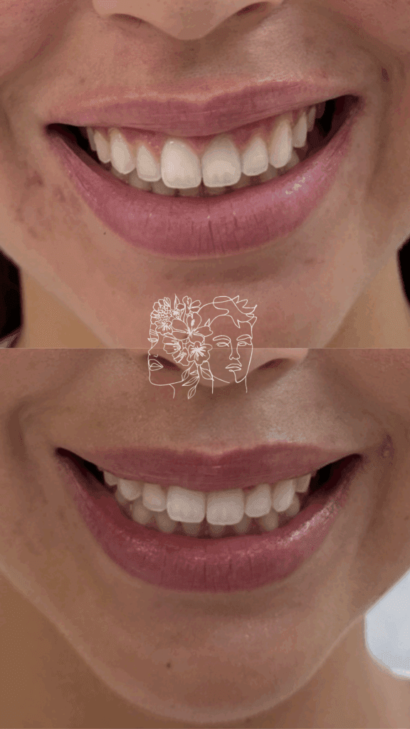 Gallery 7 a close up of a woman's teeth