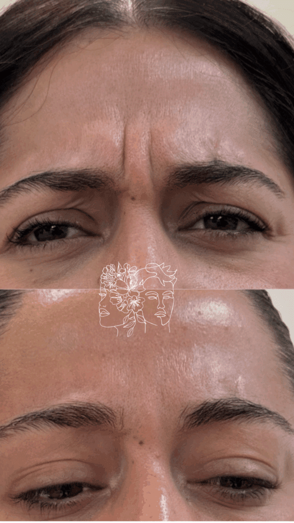 Gallery 6 a close up of a woman's face