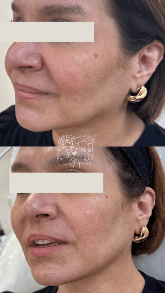 Gallery 24 An image with the filename of Yari b a