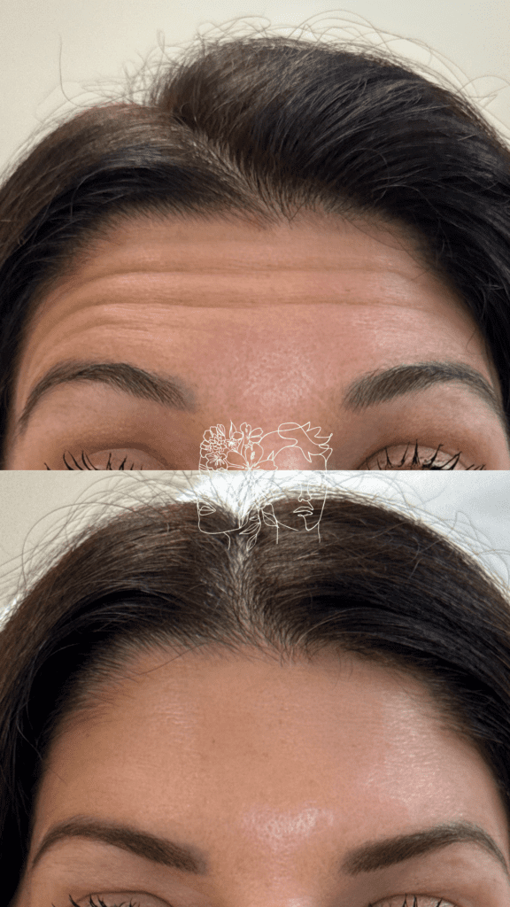 Gallery 9 An image with the filename of tox b a