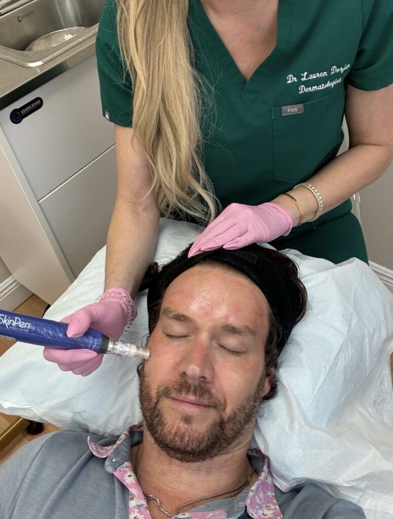 An image with the filename of SKINPEN MICRONEEDLING