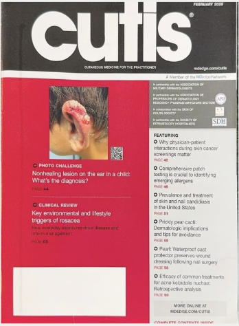 Dr. Lauren Dozier, D.O., F.A.A.D. 3 An image with the filename of cutis dozier article